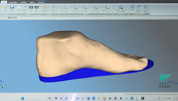 Software OrthoFoot 3D Printer